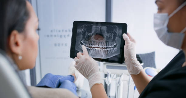Licensed Tooth Extraction service in Columbia, SC - Smile Center Dentistry